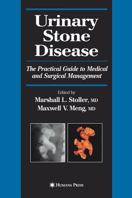 Urinary Stone Disease : The Practical Guide to Medical and Surgical Management