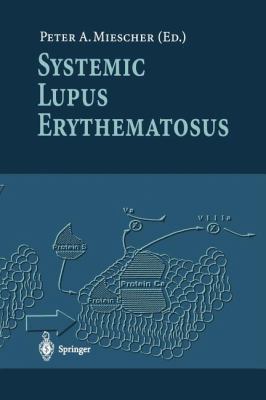 Systemic Lupus Erythematosus