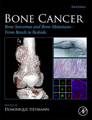 Bone Cancer : Bone Sarcomas and Bone Metastases - from Bench to Bedside