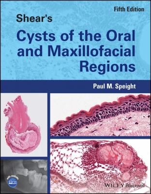 Shear's Cysts of the Oral and Maxillofacial Regions