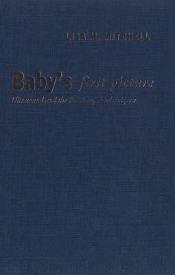 Baby's First Picture : Ultrasound and the Politics of Fetal Subjects