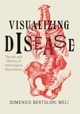 Visualizing Disease : The Art and History of Pathological Illustrations