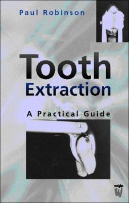 Tooth Extraction : A Practical Guide