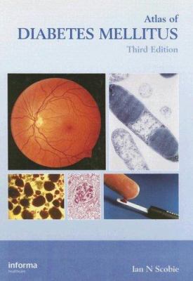Atlas of Diabetes Mellitus