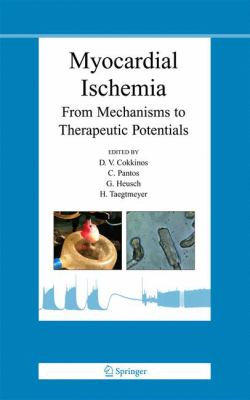 Myocardial Ischemia : From Mechanisms to Therapeutic Potentials