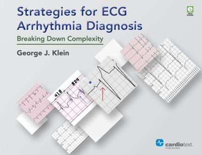 Strategies for ECG Arrhythmia Diagnosis : Breaking down Complexity