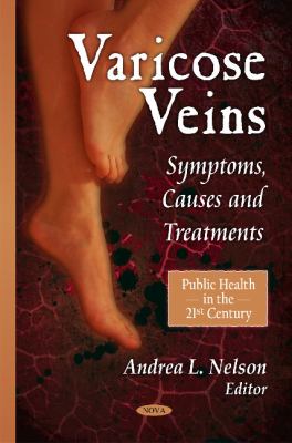 Varicose Veins : Symptoms, Causes and Treatments