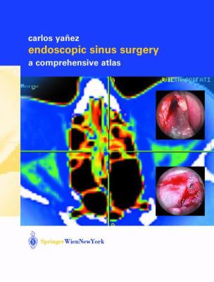 Endoscopic Sinus Surgery : A Comprehensive Atlas