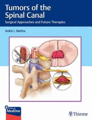 Tumors of the Spinal Canal : Surgical Approaches and Future Therapies