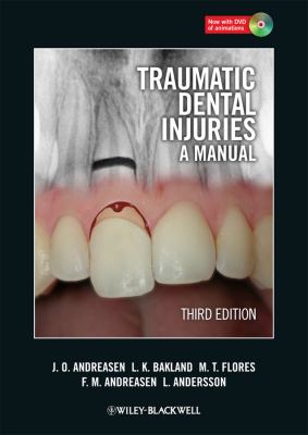 Traumatic Dental Injuries : A Manual