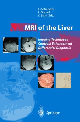 MRI of the Liver : Imaging Techniques, Contrast Enhancement, Differential Diagnosis