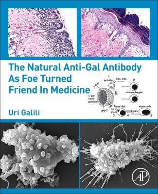 The Natural Anti-Gal Antibody as Friend and Foe in Medicine