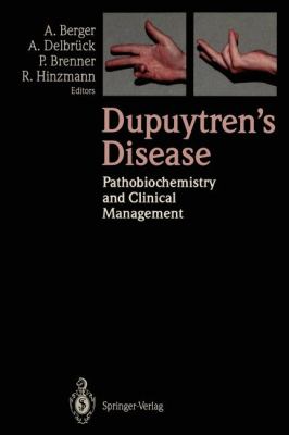 Dupuytren's Disease : Pathobiochemistry and Clinical Management