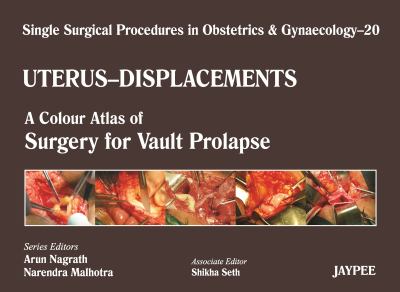 Uterus-Displacement Vol. 20 : A Colour Atlas of Surgery for Vault Prolapse