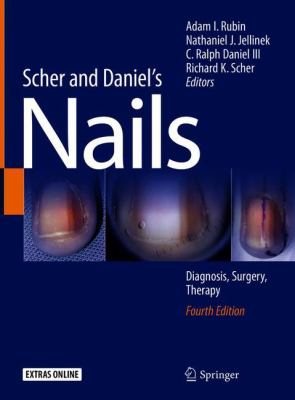Scher and Daniel's Nails : Diagnosis, Surgery, Therapy