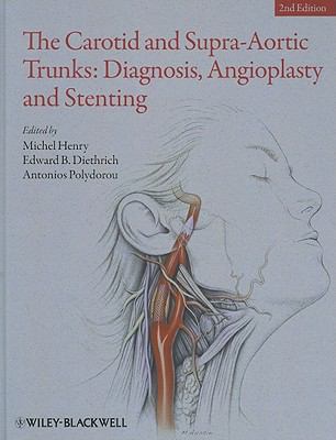 The Carotid and Supra-Aortic Trunks : Diagnosis, Angioplasty and Stenting
