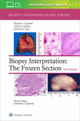 Biopsy Interpretation: the Frozen Section