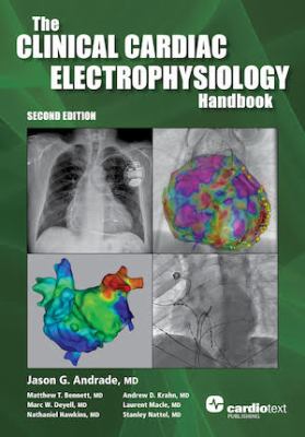 The Clinical Cardiac Electrophysiology Handbook Second Edition