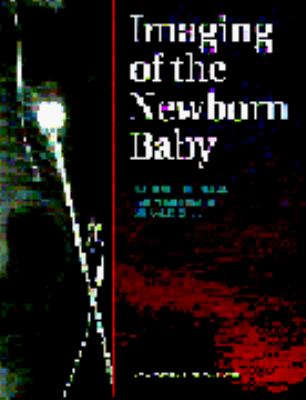 Imaging of the Newborn Baby