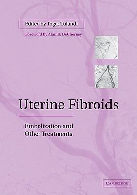 Uterine Fibroids : Embolization and Other Treatments
