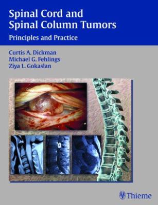 Spinal Cord and Spinal Column Tumors : Principles and Practice