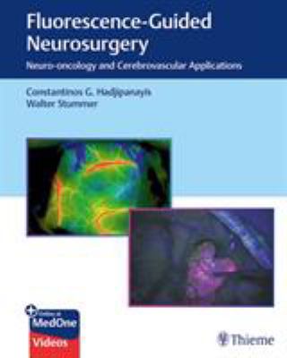 Fluorescence-Guided Neurosurgery : Neuro-Oncology and Cerebrovascular Applications