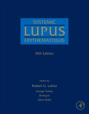 Systemic Lupus Erythematosus