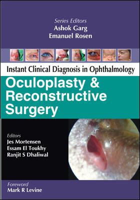 Instant Clinical Diagnosis in Ophthalmology : Oculoplasty and Reconstructive Surgery