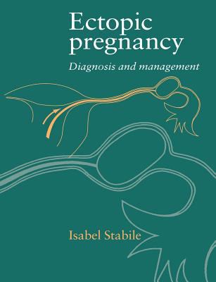 Ectopic Pregnancy : Diagnosis and Management