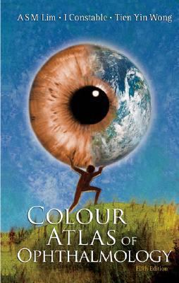 Colour Atlas of Ophthalmology (5th Ed)