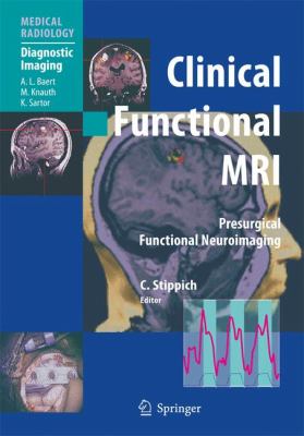 Clinical Functional MRI : Presurgical Functional Neuroimaging