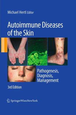 Autoimmune Diseases of the Skin : Pathogenesis, Diagnosis, Management