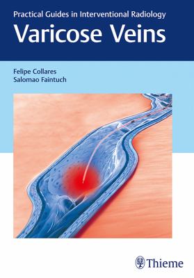 Varicose Veins : Practical Guides in Interventional Radiology