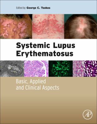 Systemic Lupus Erythematosus : Basic, Applied and Clinical Aspects