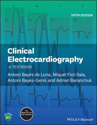 Clinical Electrocardiography : A Textbook